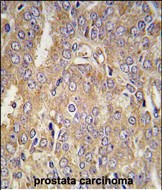 IHC-P - LTBP1 Antibody (C-term) AP7780B