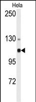 Western blot analysis of anti-ACTN4 Antibody (N-term) (Cat.#AP7790a) in Hela cell line lysates (35ug/lane). ACTN4 (arrow) was detected using the purified Pab.