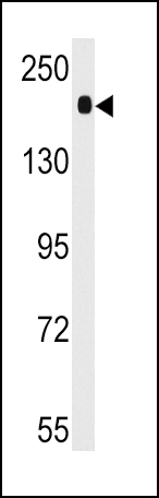 Western blot analysis of anti-ACE Antibody (C-term) (Cat.#AP7793b) in mouse lung tissue lysates (35ug/lane). ACE (arrow) was detected using the purified Pab.