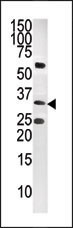 The anti-CTDSP1-V250 (Cat. #AP8461b) is used in Western blot to detect CTDSP1-V250 in CEM tissue lysate.