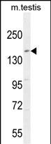 KIT Antibody (N-term D121) (Cat.#AP7656e) western blot analysis in mouse testis tissue lysates (35ug/lane).This demonstrates the KIT antibody detected the KIT protein (arrow).