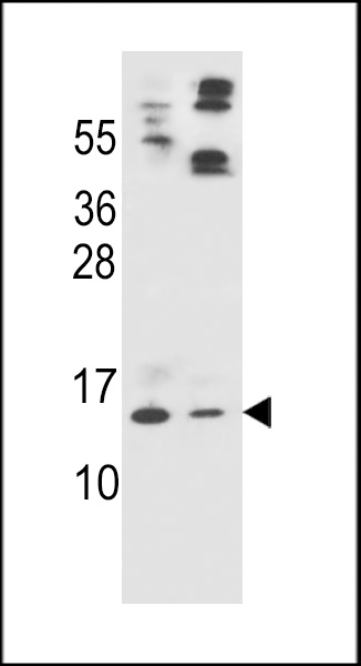 WB - APOC2 Antibody (Center) AP7796c