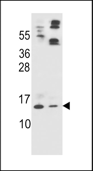 APOC2 Antibody (Center) (Cat. #AP7796c) western blot analysis in HL-60(lane 1),A549(lane 2) cell line lysates (35ug/lane).This demonstrates the APOC2 antibody detected the APOC2 protein (arrow).