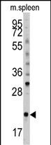 Western blot analysis of anti-mouse BID Antibody (S61) (Cat.#AP1307d) in mouse spleen tissue lysates (35ug/lane). BID (arrow) was detected using the purified Pab .
