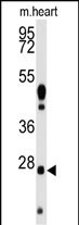 WB - WDYHV1 Antibody (Center) AP2809c