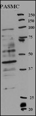 WB - RFC5 Antibody (Center R185) AP2812c