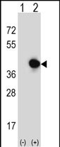 WB - RFC5 Antibody (Center R185) AP2812c