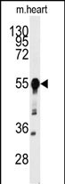Western blot analysis of anti-BACE1 Antibody (N-term) (Cat.#AP7774b) in mouse heart tissue lysates (35ug/lane). BACE1(arrow) was detected using the purified Pab.
