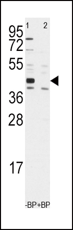 Western blot analysis of anti-ALDH1A3 Antibody (Center) (Cat.#AP7847c) pre-incubated with and without blocking peptide in Jurkat cell line lysate. ALDH1A3 (arrow) was detected using the purified Pab.