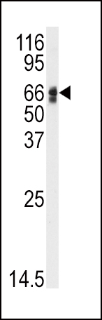 Western blot analysis of anti-AGT Antibody (N-term) (Cat.#AP7854a) in HepG2 cell line lysates (35ug/lane). AGT(arrow) was detected using the purified Pab.