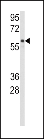 Western blot analysis of anti-CYP2C9 Antibody (N-term) (Cat.#AP7874a) in Jurkat cell line lysates (35ug/lane). CYP2C9(arrow) was detected using the purified Pab.