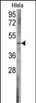 WB - BCL2L13 Antibody (C-term) AP7878b