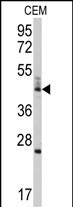 WB - BCL2L13 Antibody (Center) AP7878c