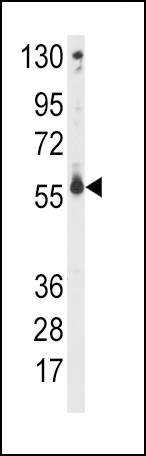 Western blot analysis of anti-CYP2C9 Antibody (Center)(Cat.#AP7881c) in CEM cell line lysates (35ug/lane).CYP2C9(arrow) was detected using the purified Pab.