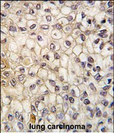 IHC-P - CYP2F1 Antibody (C-term) AP7883b