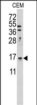 Western blot analysis of anti-LSM1 Antibody (C-term) (Cat.#AP2863b) in CEM cell line lysates (35ug/lane). LSM1 (arrow) was detected using the purified Pab.
