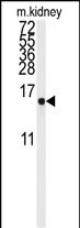 Western blot analysis of anti-LSM1 Antibody (Center) (Cat.#AP2863c) in mouse kidney tissue lysates (35ug/lane). LSM1(arrow) was detected using the purified Pab.