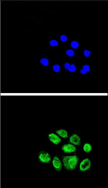 Confocal immunofluorescent analysis of EXO1 Antibody (N-term) (Cat. #AP2871a) with A549 cell followed by Alexa Fluor� 489-conjugated goat anti-rabbit lgG (green). DAPI was used to stain the cell nuclear (blue).