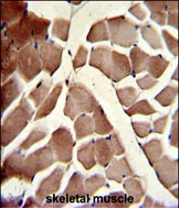 IHC-P - COG4 Antibody (C-term) AP7430b