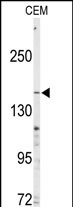 Western blot analysis of anti-ABCC4 Antibody (C-term)(Cat.#AP7436b) in CEM cell line lysates (35ug/lane). ABCC4 (arrow) was detected using the purified Pab.