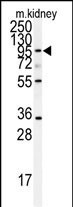 Western blot analysis of anti-ADAM9 Antibody (N-term)(Cat.#AP7437a) in mouse kidney tissue lysates (35ug/lane). ADAM9 (arrow) was detected using the purified Pab.