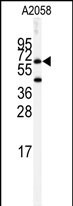Western blot analysis of anti-BCHE Antibody (Center)(Cat.#AP7829c) in A2058 cell line lysates (35ug/lane). BCHE (arrow) was detected using the purified Pab.