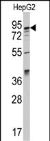 Western blot analysis of anti-AAK1 Antibody (C-term) (Cat.#AP7861b) in HepG2 cell line lysates (35ug/lane). AAK1 (arrow) was detected using the purified Pab.