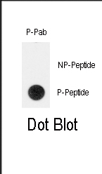 DB - Phospho-TERT(Y707) Antibody AP3619a