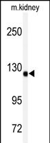 WB - ADAMTS19 Antibody (Center) AP7448c