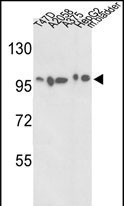 Western blot analysis of ACTN4 Antibody (C-term) (Cat.#AP7790b) in T47D, A2058, A375, HepG2 cell line and mouse bladder tissue lysates (35ug/lane). ACTN4 (arrow) was detected using the purified Pab.
