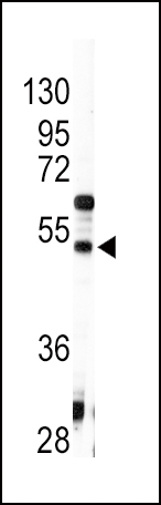 Western blot analysis of anti-AGT Antibody (C-term) (Cat.#AP7854b) in HepG2 cell line lysates (35ug/lane). AGT (arrow) was detected using the purified Pab.