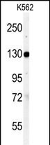 Western blot analysis of anti-VINC Antibody (N-term) (Cat.#AP7426a) in K562 cell line  lysates (35ug/lane). VINC (arrow) was detected using the purified Pab.