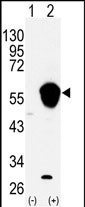 Western blot analysis of ALDH3A1 (arrow) using rabbit polyclonal ALDH3A1 Antibody (N-term) (Cat.#AP7849a). 293 cell lysates (2 ug/lane) either nontransfected (Lane 1) or transiently transfected with the ALDH3A1 gene (Lane 2) (Origene Technologies).