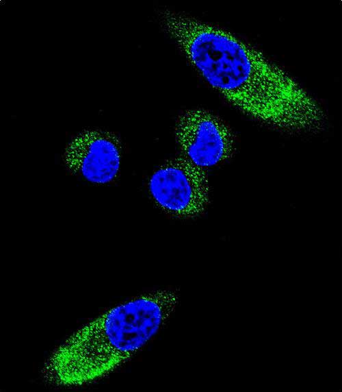 Confocal immunofluorescent analysis of CYP1A1 Antibody (Center)(Cat#AP7993c) with MDA-MB231 cell followed by Alexa Fluor 488-conjugated goat anti-rabbit lgG (green).DAPI was used to stain the cell nuclear (blue).