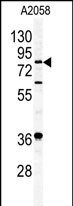 Western blot analysis of APEH antibody (N-term)(Cat.#AP1255a) in A2058 cell line lysates (35ug/lane). APEH (arrow) was detected using the purified Pab.