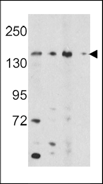 WB - OPLAH Antibody (N-term) AP7475a