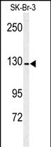 Western blot analysis of ANPEP antibody (Center)(Cat.#AP7601c) in SK-Br-3 cell line lysates (35ug/lane). ANPEP (arrow) was detected using the purified Pab.