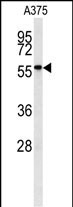 WB - NAB2 Antibody (Center) AP7635c