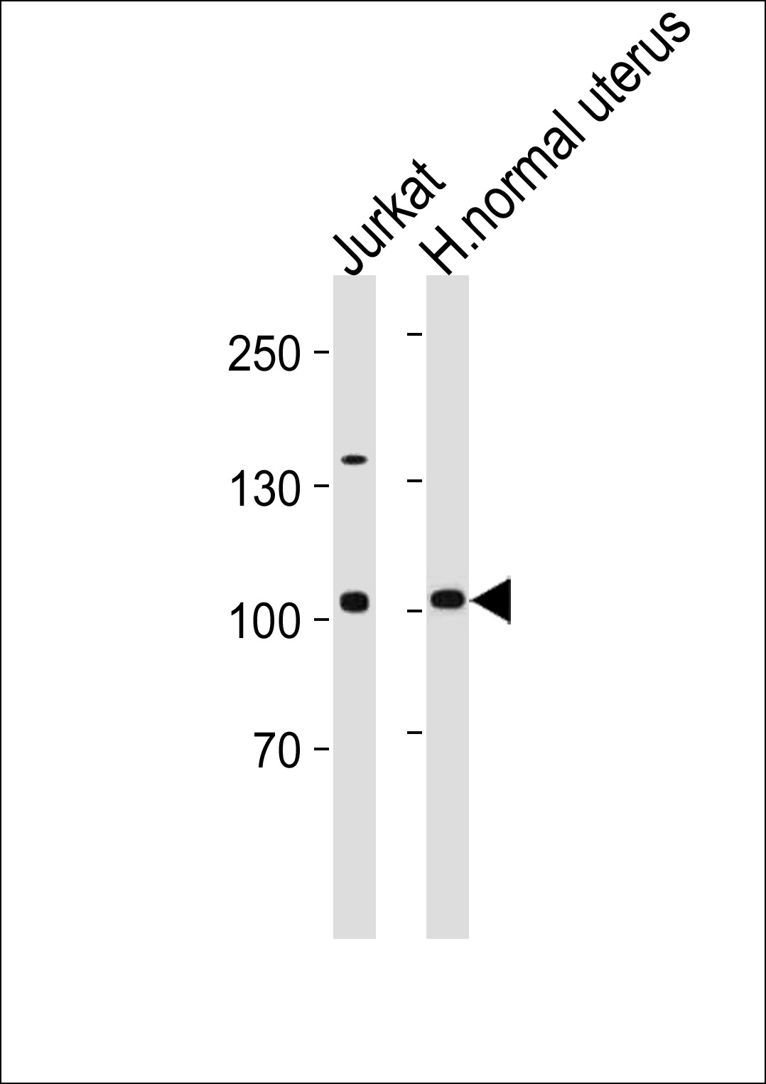 WB - TERT Antibody (S1125) AP1410d