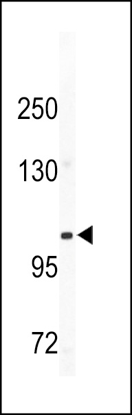 Western blot analysis of CD49e antibody (C-term) (Cat.# AP2876b) in  mouse bladder tissue  lysates (35ug/lane). CD49e (arrow) was detected using the purified Pab.