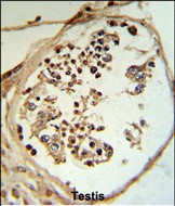 IHC-P - LYAR Antibody (N-term) AP7328a