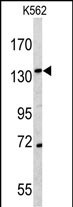 Western blot analysis of CD163 antibody (N-term) (Cat.#AP7330a) in K562 cell line lysates (35ug/lane). CD163 (arrow) was detected using the purified Pab.