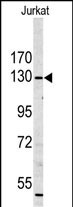 WB - MYO1A Antibody (Center S291) AP7343c