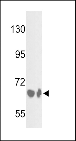 Western blot analysis of BF Antibody (Center) (Cat.# AP7357c) in HepG2 cell line and mouse liver tissue lysates (35ug/lane). BF (arrow) was detected using the purified Pab.