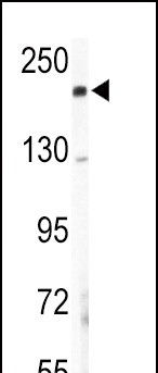 Western blot analysis of COL5A2 Antibody (N-term) (Cat.# AP7358a) in mouse lung tissue lysates (35ug/lane). COL5A2 (arrow) was detected using the purified Pab.