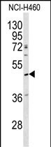 Western blot analysis of SERPINA4 antibody (C-term) (Cat.#AP7455b) in NCI-H460 cell line lysates (35ug/lane). SERPINA4 (arrow) was detected using the purified Pab.