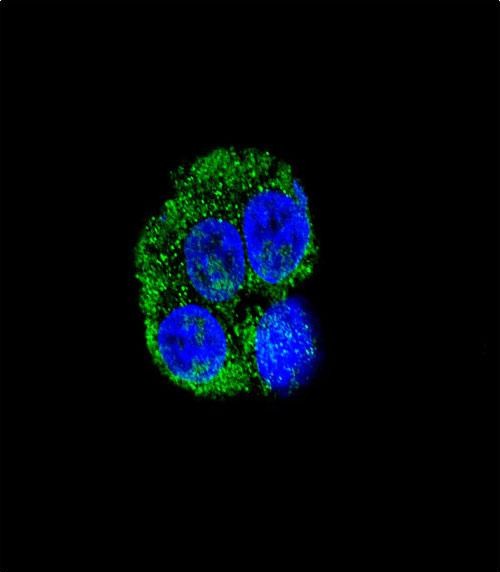 Confocal immunofluorescent analysis of CD36 Antibody (Center)(Cat#AP2883c) with HepG2 cell followed by Alexa Fluor� 488-conjugated goat anti-rabbit lgG (green). DAPI was used to stain the cell nuclear (blue).