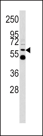 WB - UDB17 Antibody (Center) AP6505c