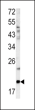 Western blot analysis of GCG antibody (N-term) (Cat.# AP6515a) in mouse bladder tissue lysates (35ug/lane). GCG (arrow) was detected using the purified Pab.