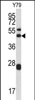 Western blot analysis of ARPC1A antibody (Center) (Cat.# AP6519c) in Y79 cell line lysates (35ug/lane). ARPC1A (arrow) was detected using the purified Pab.